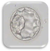 ตัวอ่อนที่ปฏิสนธิ (Zygote : Day 1)