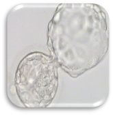 ตัวอ่อนที่ปฏิสนธิ (Zygote : Day 1)