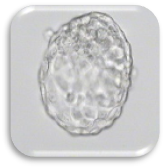 ตัวอ่อนที่ปฏิสนธิ (Zygote : Day 1)